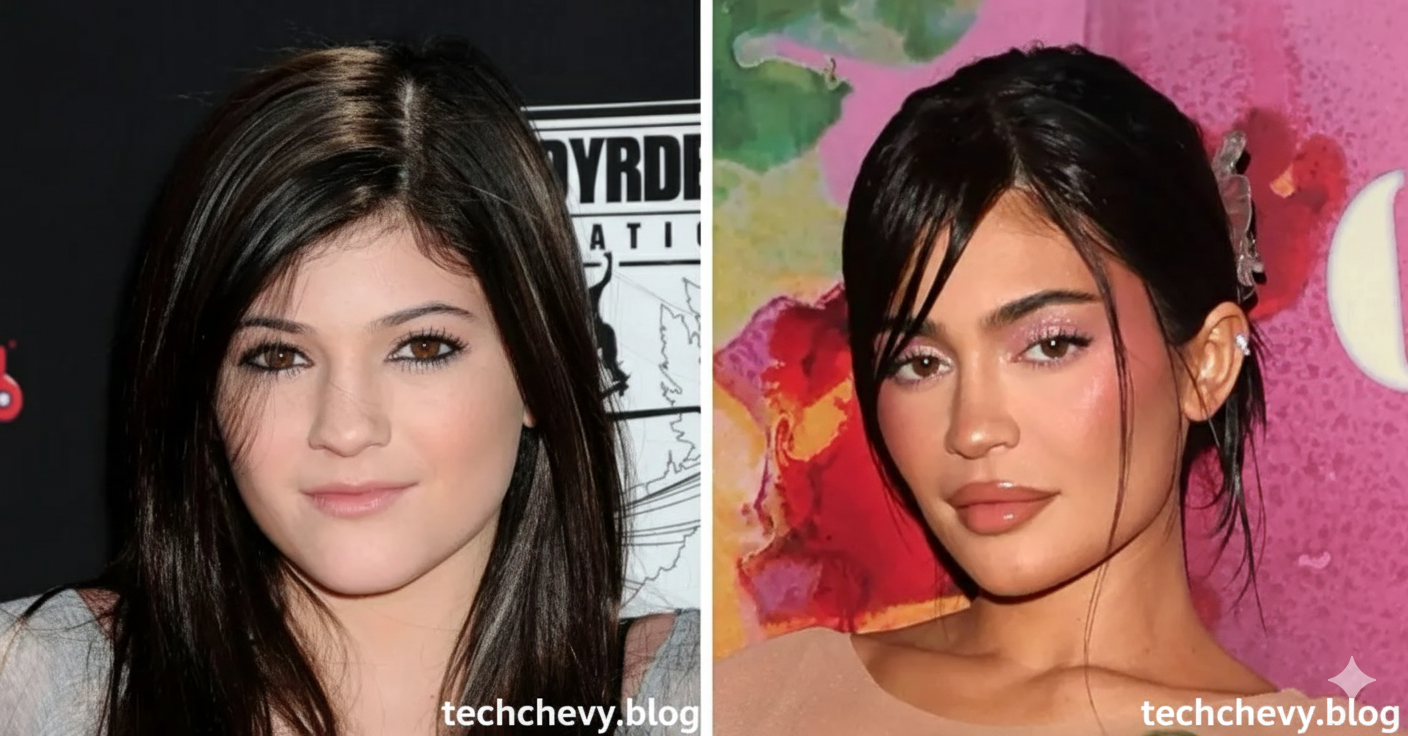kylie jenner before plastic surgery